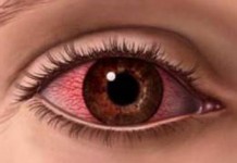 En İğrenç Espiriler