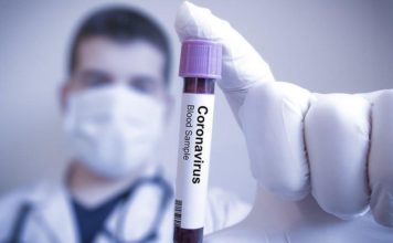 Corona Virüs Testi Nasıl Yapılır?