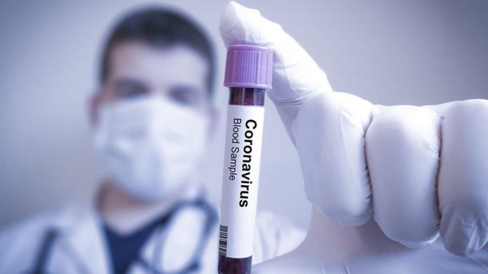 corona_testi_nasil_yapilir